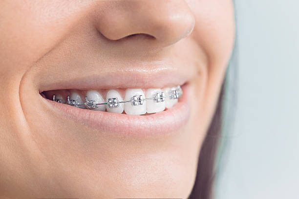Best Veneers and Lumineers  in Whitestown, IN